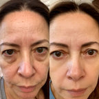 Red Light Therapy | Lumière® Bellucci Skin Milan