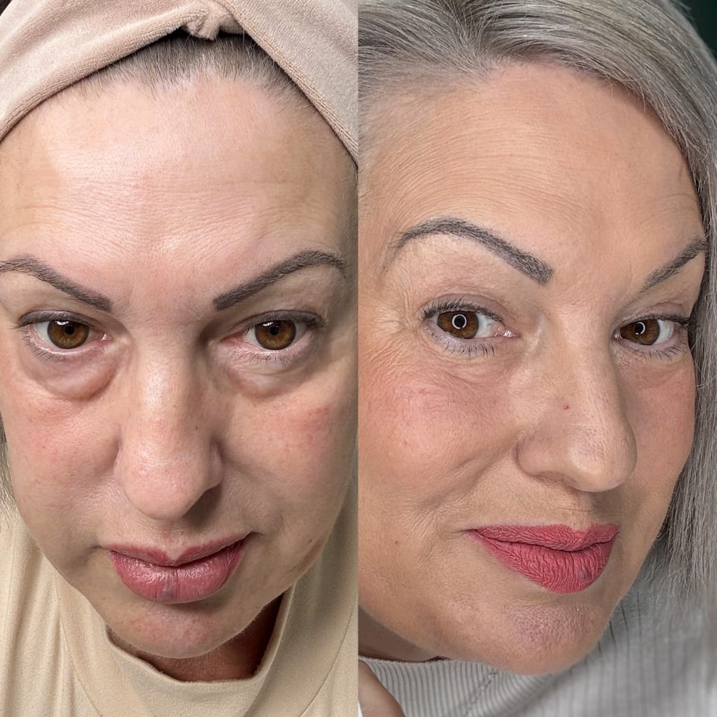 Red Light Therapy | Lumière® Bellucci Skin Milan